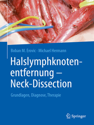 cover image of Halslymphknotenentfernung – Neck-Dissection